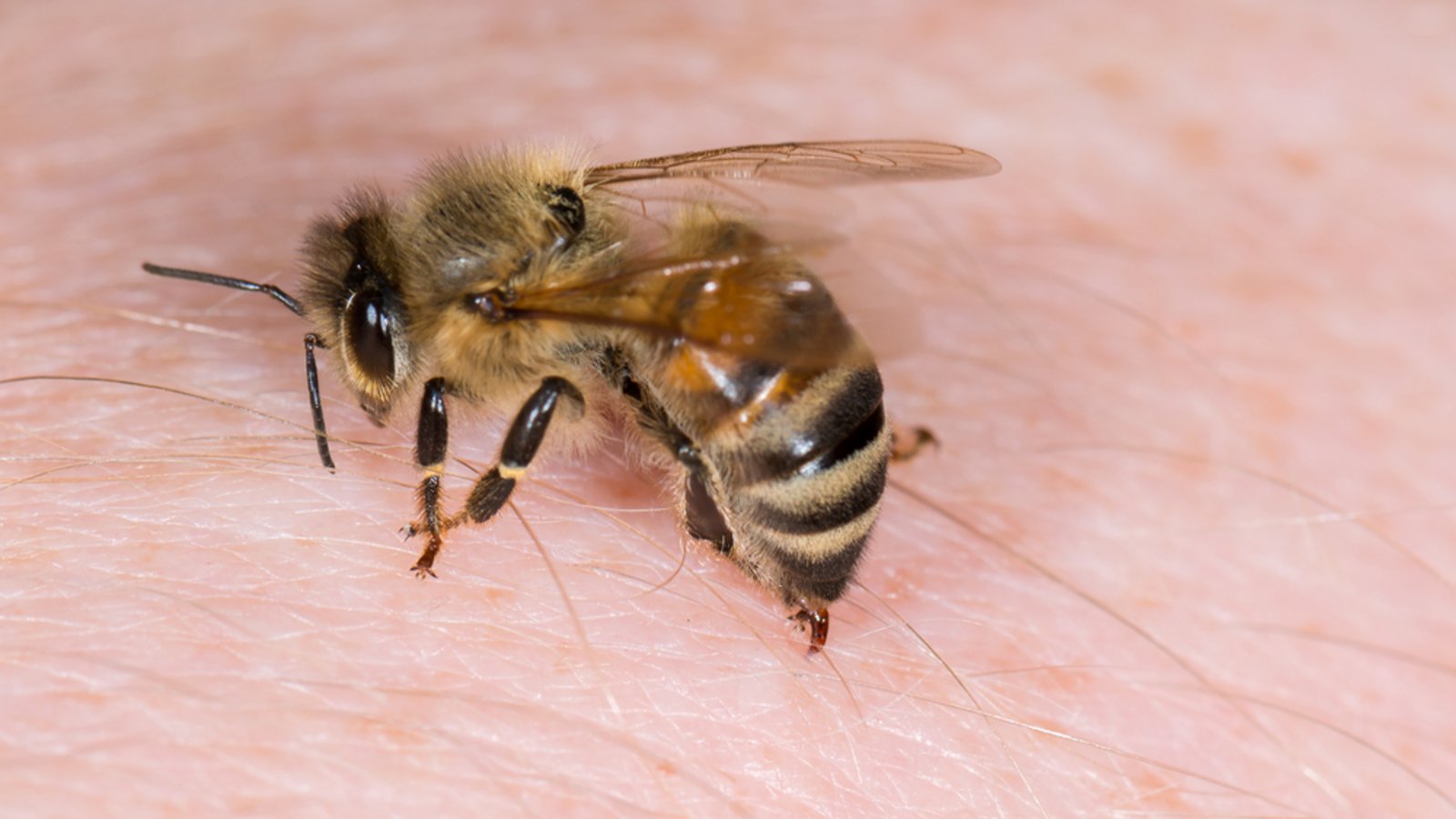 So entfernen Sie den Stachel der Biene.Foto: Mirko Graul / shutterstock.com