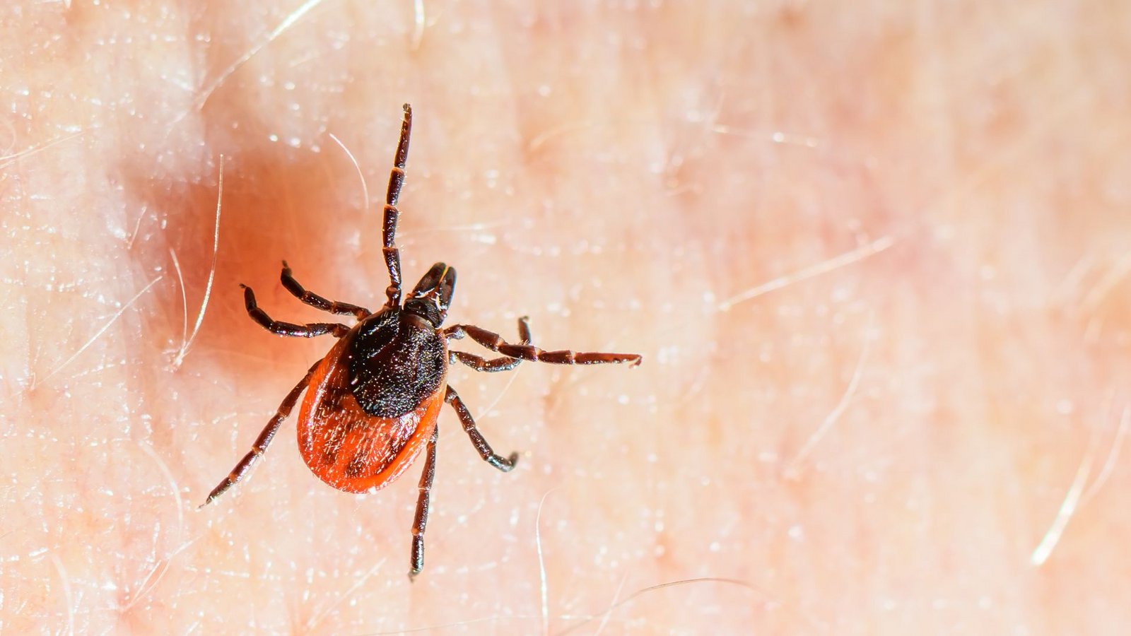 Der Gemeine Holzbock ist die häufigste Zeckenart in Deutschland und auch die, die hauptsächlich FSME und Borreliose auf den Menschen übertragt. (Archivbild)Foto: Patrick Pleul/dpa