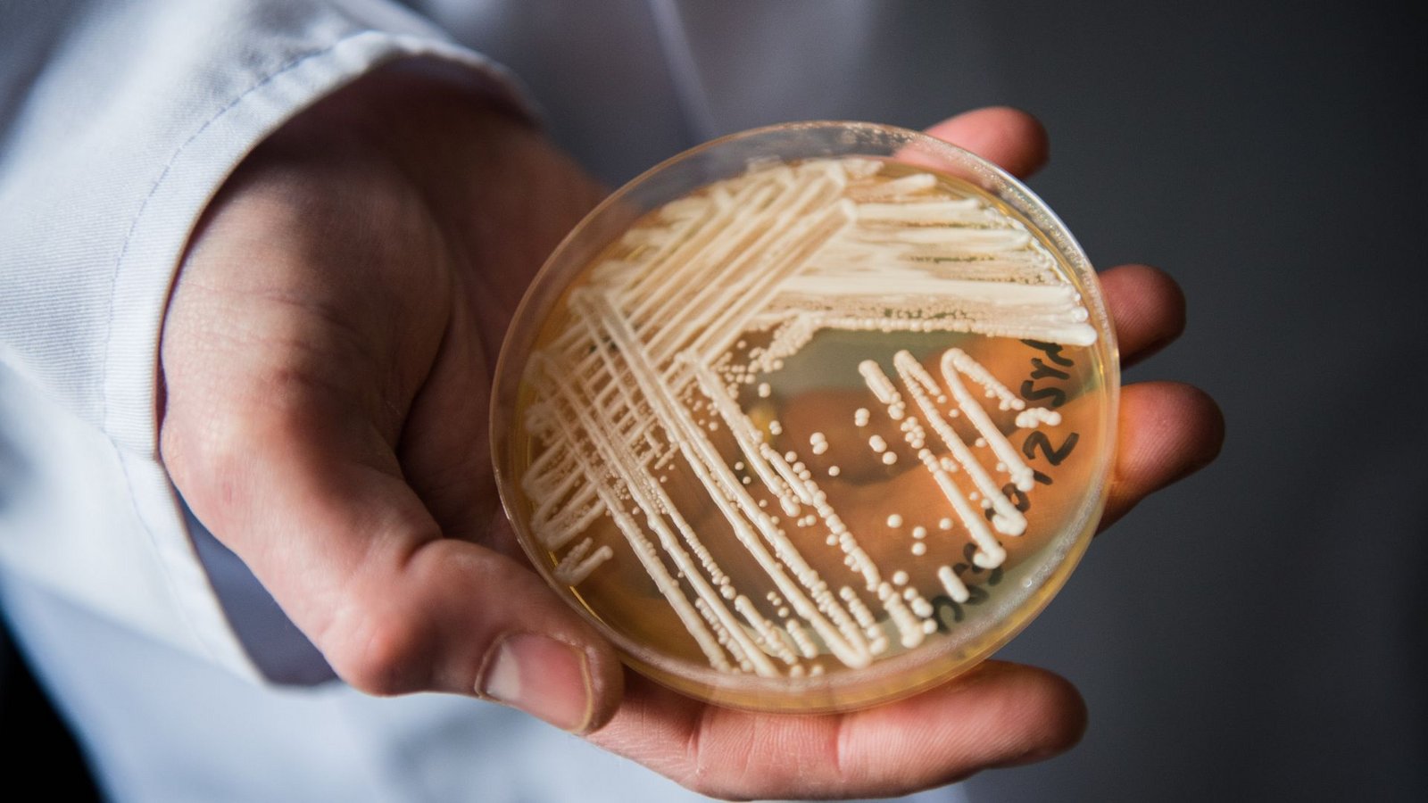 Eine Petrischale mit dem Hefepilz Candida auris. In Deutschland werden immer mehr Fälle des krankmachenden Pilzes bekannt.Foto: Nicolas Armer/dpa