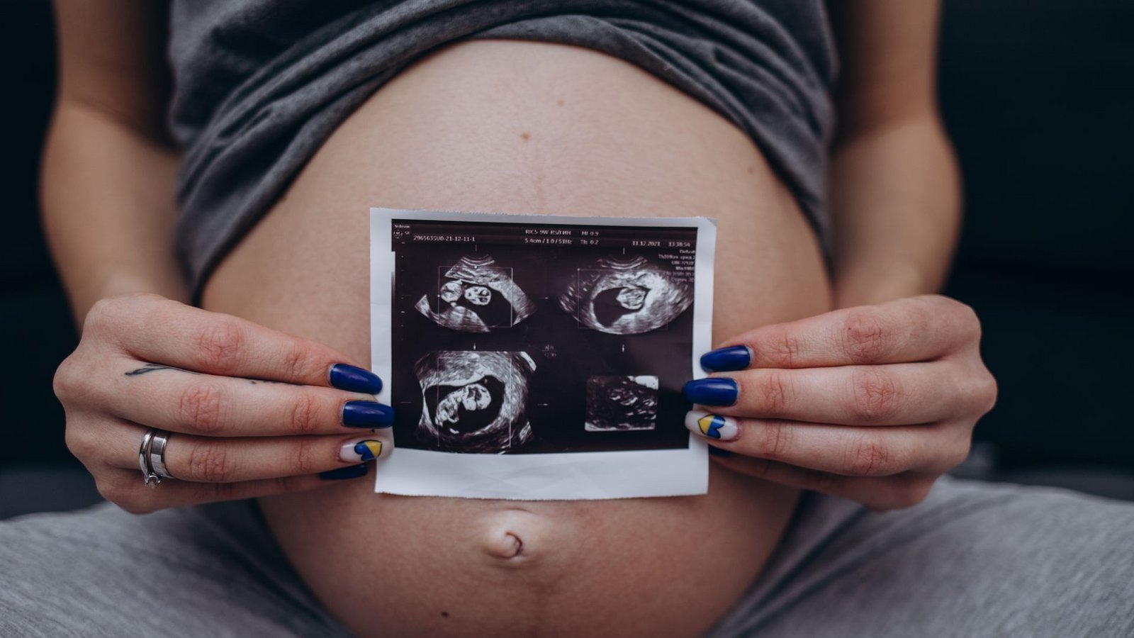 Eine werdende Mutter zeigt Ultraschallaufnahmen des heranwachsenden Babys in ihrem Mutterleib. (Symbolbild)Foto: IMAGO/Pond5 Images/IMAGO/xfentonromax Eine werdende Mutter zeigt Ultraschallaufnahmen des heranwachsenden Babys in ihrem Mutterleib. (Symbolbild)Foto: IMAGO/Pond5 Images/IMAGO/xfentonromax