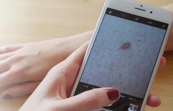 Nutzer können Bilder von Hautstellen hochladen und beurteilen lassen. Je nach Anbieter werden die Fotos mit Algorithmen oder durch Dermatologen analysiert.<span class='image-autor'>Foto: AppDoc</span>