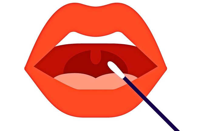 Je nach Anbieter muss man einen Abstrich der Mundschleimhaut mit dem  Wattestäbchen  eine Speichelprobe einschicken.<span class='image-autor'>Foto: Iuliia - stock.adobe.com</span>