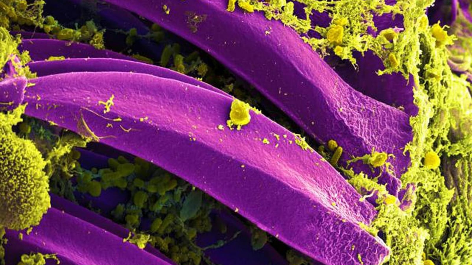 Kleiner Erreger, große Wirkung: Yersinia-pestis-Bakterium unter dem Elektronenmikroskop.Imago/World History Archive Kleiner Erreger, große Wirkung: Yersinia-pestis-Bakterium unter dem Elektronenmikroskop.Imago/World History Archive