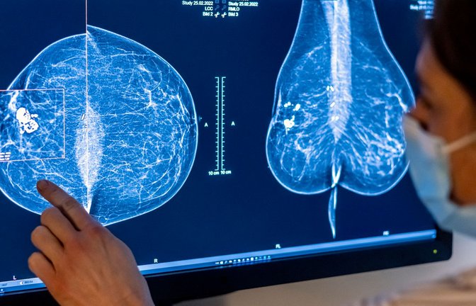 Brustkrebs ist die häufigste Krebserkrankung bei Frauen in Deutschland.<span class='image-autor'>Foto: Hannibal Hanschke/dpa</span>