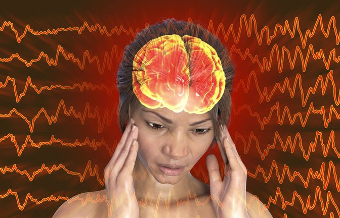 Neurologen haben einen bisher unbekannten Signalweg entdeckt, über den Migräne-Beschwerden bei Patienten mit Aura ausgelöst werden.<span class='image-autor'>Foto: Imago/Dreamstime</span>