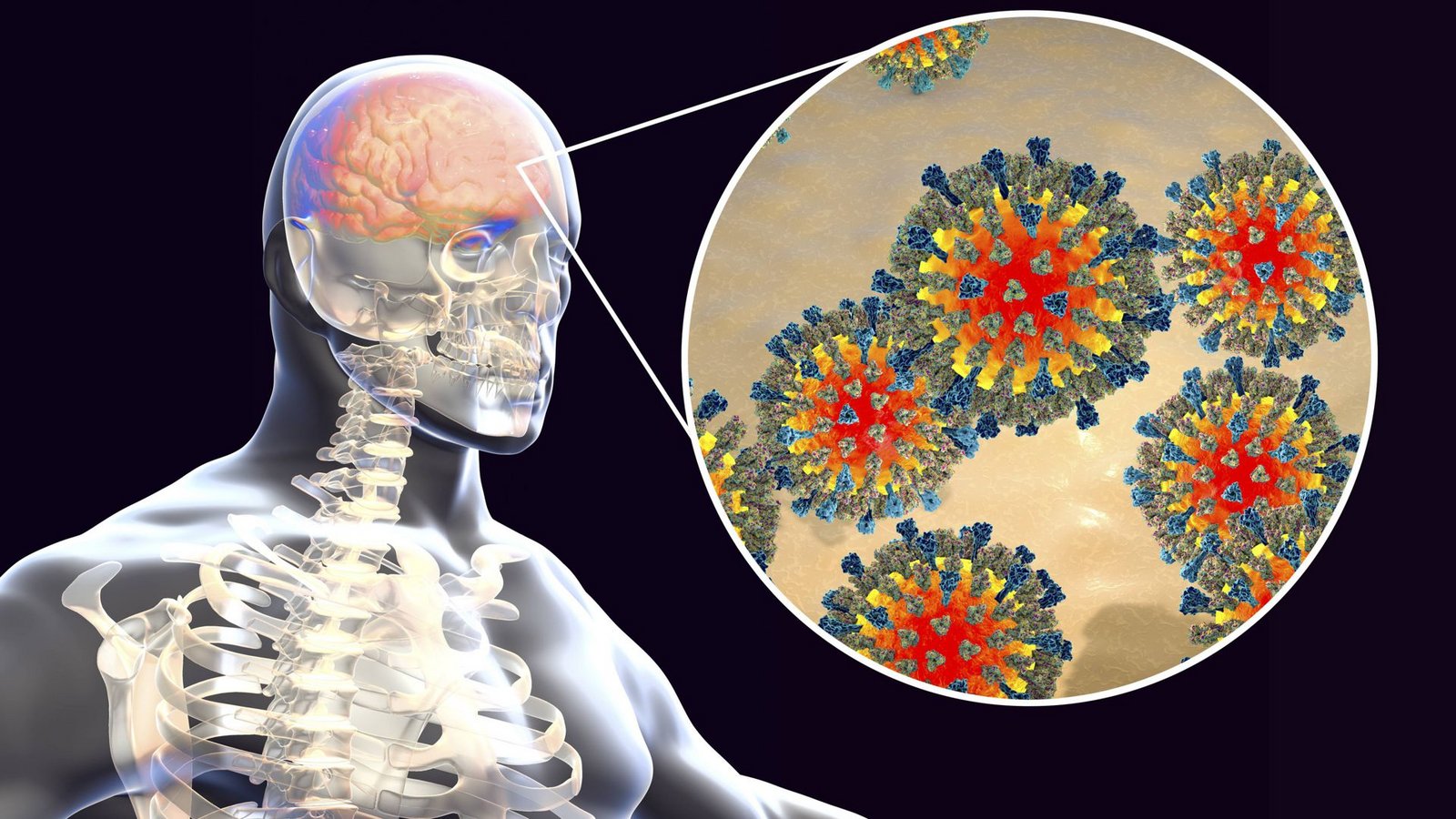 Nicht nur heutige Viren machen krank. Auch die Gen-Reste von uralten Viren im Erbgut können zu Erkrankungen der Psyche und des Nervensystems führen.Foto: Imago/Science Photo Library Nicht nur heutige Viren machen krank. Auch die Gen-Reste von uralten Viren im Erbgut können zu Erkrankungen der Psyche und des Nervensystems führen.Foto: Imago/Science Photo Library