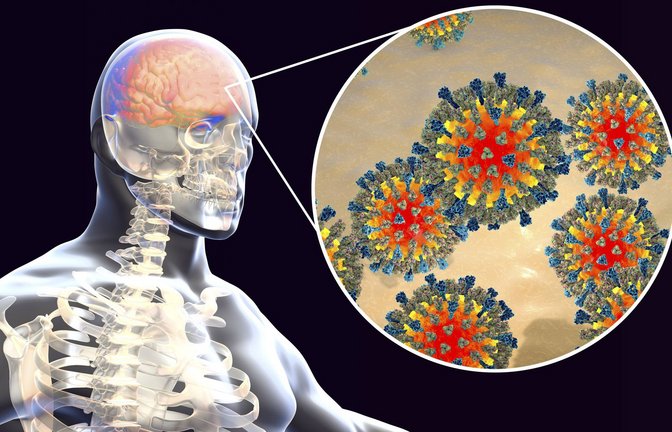 Nicht nur heutige Viren machen krank. Auch die Gen-Reste von uralten Viren im Erbgut können zu Erkrankungen der Psyche und des Nervensystems führen.<span class='image-autor'>Foto: Imago/Science Photo Library</span>
