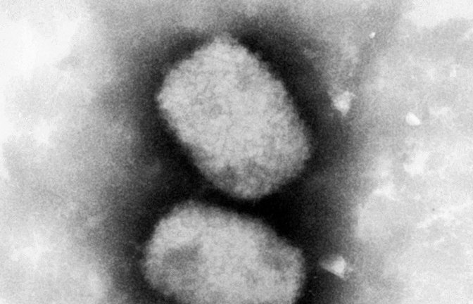 Diese vom Robert Koch-Institut (RKI) zur Verfügung gestellte elektronenmikroskopische Aufnahme zeigt das Affenpockenvirus. In Großbritannien sind vier weitere Fälle erfasst worden.<span class='image-autor'>Foto: Andrea Männel/RKI/dpa</span>