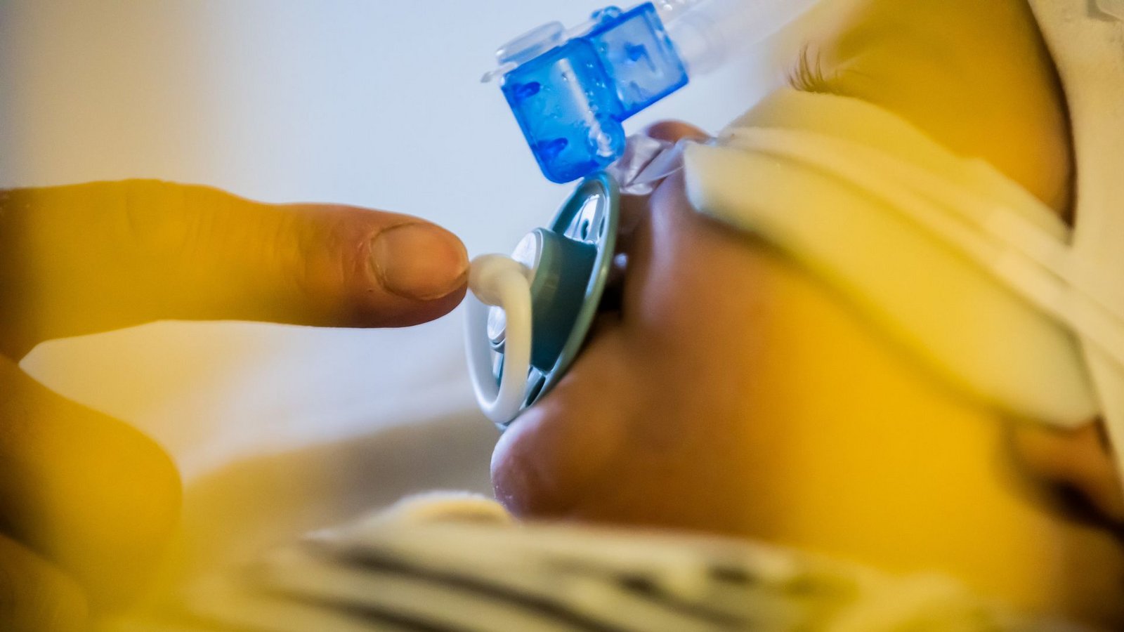 Im Herbst 2022 waren viele Kinderkliniken wegen Atemwegsinfekten bei Kleinkindern und Säuglingen überlastet.Foto: dpa/Christoph Soeder Im Herbst 2022 waren viele Kinderkliniken wegen Atemwegsinfekten bei Kleinkindern und Säuglingen überlastet.Foto: dpa/Christoph Soeder