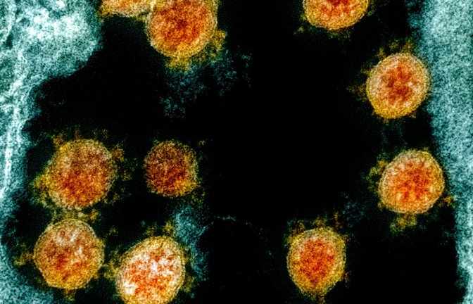 Partikel des Coronavirus SARS-CoV-2 wurden für eine elektronenmikroskopische Aufnahme farblich bearbeitet.<span class='image-autor'>Foto: Uncredited/NIAID/NIH/dpa</span>
