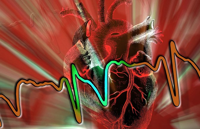 Ein  Herzinfarkt kann jederzeit in ein Kammerflimmern übergehen. Das Herz schlägt dann völlig chaotisch – über 300-mal pro Minute. Innerhalb weniger Sekunden droht der  Herzstillstand.<span class='image-autor'>Foto: Imago/Panthermedia</span>