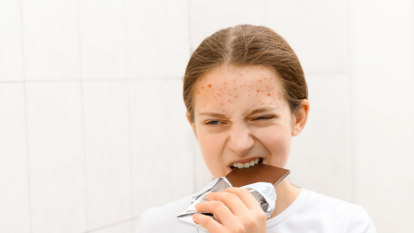 Gerbsäuren und gesättigte Fette im Kakao der Schokolade fördern nicht nur Entzündungen, sondern auch das Wachstum von Akne-Bakterien.Foto: soleg - stock.adobe.com/SAENCO OLEG Gerbsäuren und gesättigte Fette im Kakao der Schokolade fördern nicht nur Entzündungen, sondern auch das Wachstum von Akne-Bakterien.Foto: soleg - stock.adobe.com/SAENCO OLEG