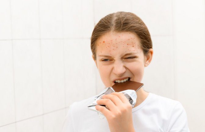 Gerbsäuren und  gesättigte Fette im Kakao der Schokolade fördern nicht nur Entzündungen, sondern auch das Wachstum von Akne-Bakterien.<span class='image-autor'>Foto: soleg - stock.adobe.com/SAENCO OLEG</span>