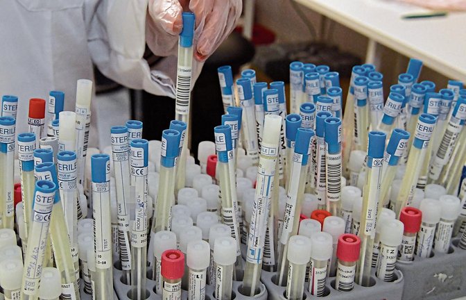 Im MVZ Labor in Ludwigsburg werden neben anderen auch bis zu 7000 PCR-Corona-Tests pro Woche ausgewertet. Fotos: Kalb
