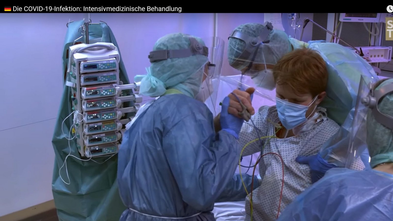 Foto: Screenshot youtube.de/Uniklinikum Tübingen