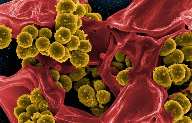 Multiresistenter Keim: Das Bakterium Staphylococcus aureus (gelb) mit zerstörte menschlichen weißes Blutzellen (rot).<span class='image-autor'>Foto: Imago/BSIP</span>