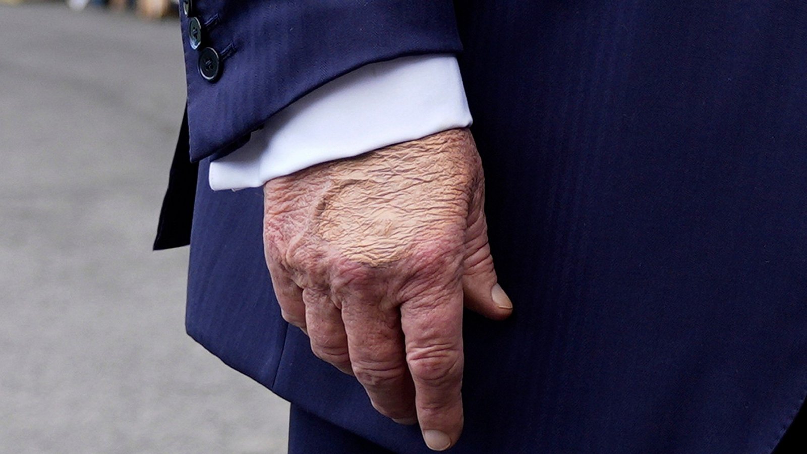 In den vergangenen Tagen hatten Medien über Blutergüsse an einer Hand Trumps und über Schwellungen an seinen Beinen spekuliert.Foto: Manuel Balce Ceneta/AP/dpa