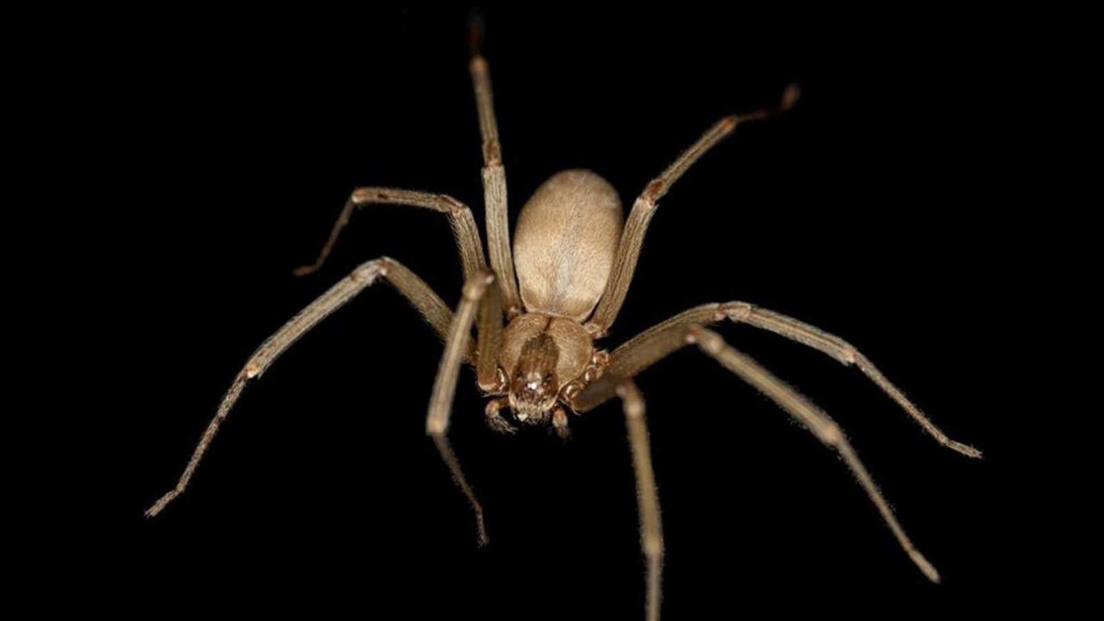 Braune Einsiedlerspinne (Loxosceles reclusa): Die sechs bis 20 Millimetern große Spinne kommt vor allem im Mittleren Westen bis in den Süden der USA vor. Ihr Biss ist meist schmerzlos und klein. Innerhalb der nächsten zwölf Stunden nehmen die Schmerzen zu, die betroffene Stelle wird größer. Weitere mögliche körperliche Symptome: Kopfschmerzen, Übelkeit, Erbrechen, Krämpfe und Muskelschmerzen.Foto: Wikipedia commons/Rosa Pineda/CC BY-SA 3.0 Braune Einsiedlerspinne (Loxosceles reclusa): Die sechs bis 20 Millimetern große Spinne kommt vor allem im Mittleren Westen bis in den Süden der USA vor. Ihr Biss ist meist schmerzlos und klein. Innerhalb der nächsten zwölf Stunden nehmen die Schmerzen zu, die betroffene Stelle wird größer. Weitere mögliche körperliche Symptome: Kopfschmerzen, Übelkeit, Erbrechen, Krämpfe und Muskelschmerzen.Foto: Wikipedia commons/Rosa Pineda/CC BY-SA 3.0