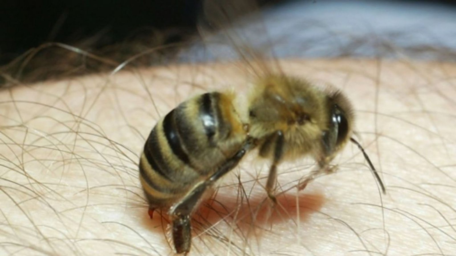 Pieks! Autsch, das tut weh! Wenn (wie hier im Bild) eine Honigbiene zusticht, gelangt ihr Gift in den Körper und verursacht Röttungen und schmerzhafte Schwellungen.Foto: d/a Pieks! Autsch, das tut weh! Wenn (wie hier im Bild) eine Honigbiene zusticht, gelangt ihr Gift in den Körper und verursacht Röttungen und schmerzhafte Schwellungen.Foto: d/a