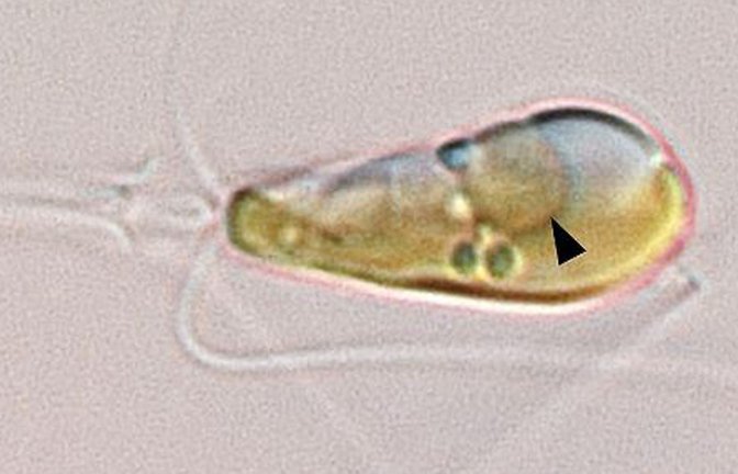 Der schwarze Pfeil zeigt den Nitroplast – eine Art Miniorgan oder Organell – in der aus Meeresalge und Cyanobakterium fusionierten Alge.<span class='image-autor'>Foto: Tyler Coale</span>
