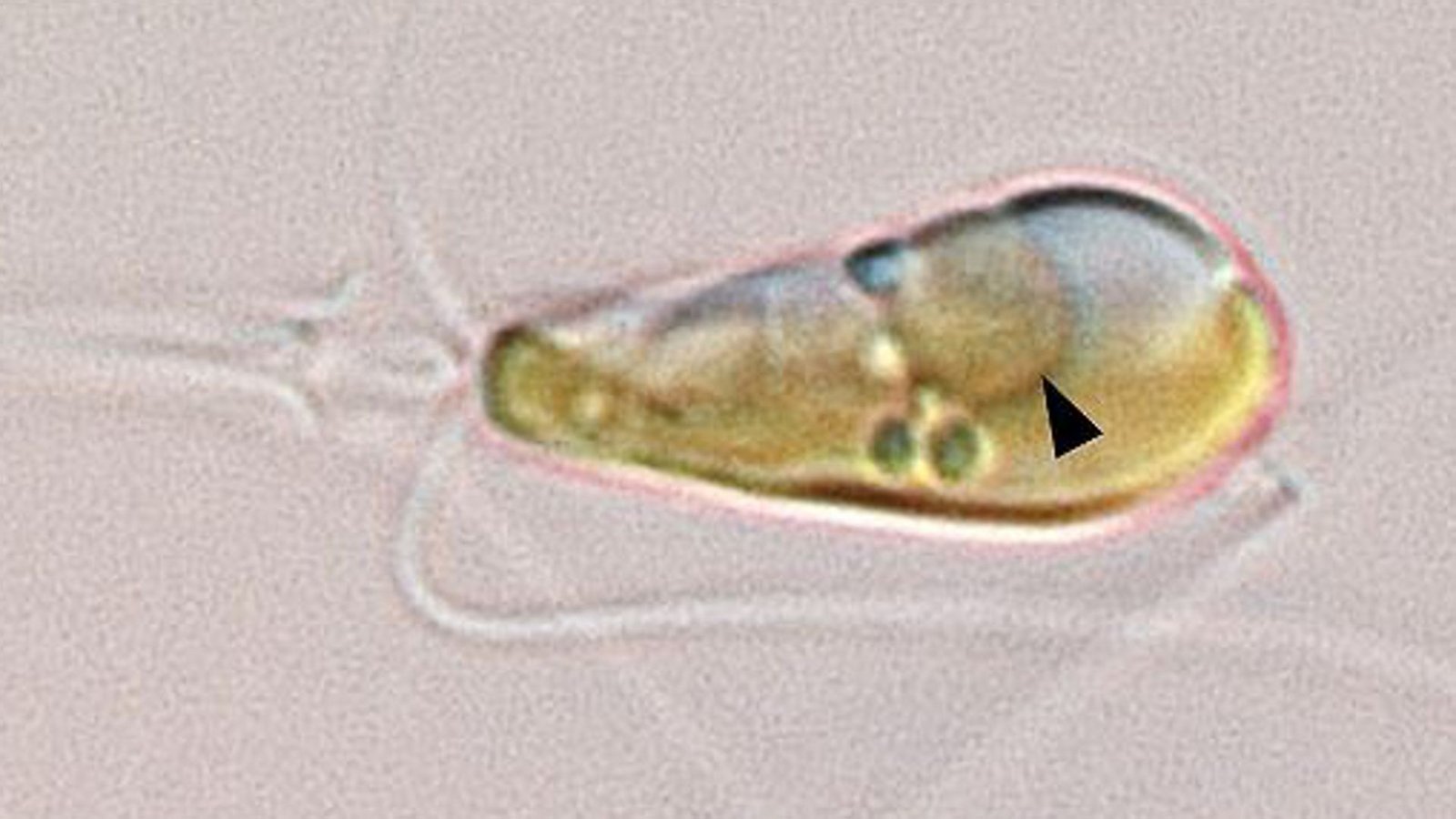Der schwarze Pfeil zeigt den Nitroplast – eine Art Miniorgan oder Organell – in der aus Meeresalge und Cyanobakterium fusionierten Alge.Foto: Tyler Coale