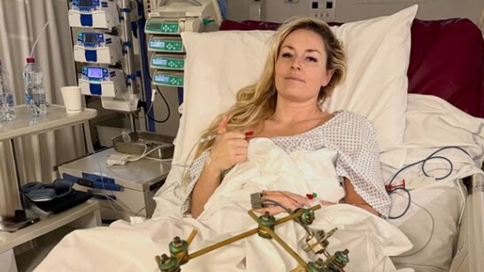 Dieses Foto postete Lindsey Vonn am Mittwoch aus dem Krankenhaus.Foto: Instagram/Lindsey Vonn Dieses Foto postete Lindsey Vonn am Mittwoch aus dem Krankenhaus.Foto: Instagram/Lindsey Vonn
