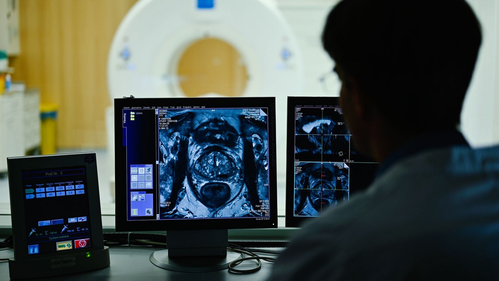 Nach dem Anfangsverdacht auf Prostatakrebs kommen im Verlauf einer Diagnostik auch bildgebende Verfahren zum Einsatz. (Archivbild)Foto: Uwe Anspach/dpa/dpa-tmn