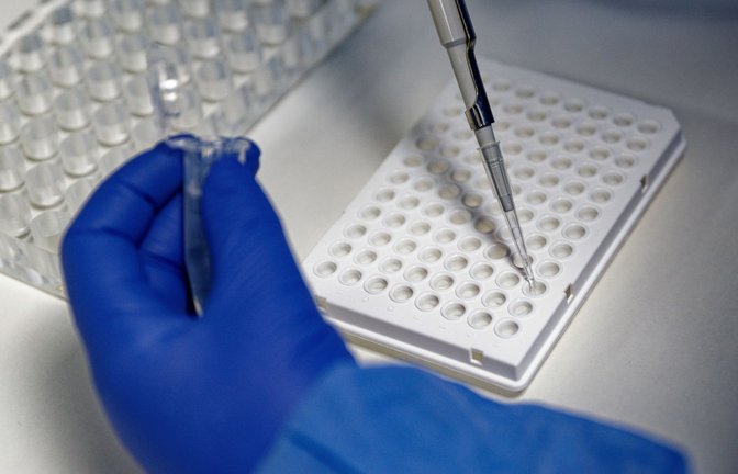 Eine Mitarbeiterin des Labors CBT füllt mit einer Pipette zur Vorbereitung von Corona PCR-Tests eine Testflüssigkeit in einer Trägerplatte.<span class='image-autor'>Foto: dpa/Henning Kaiser</span>