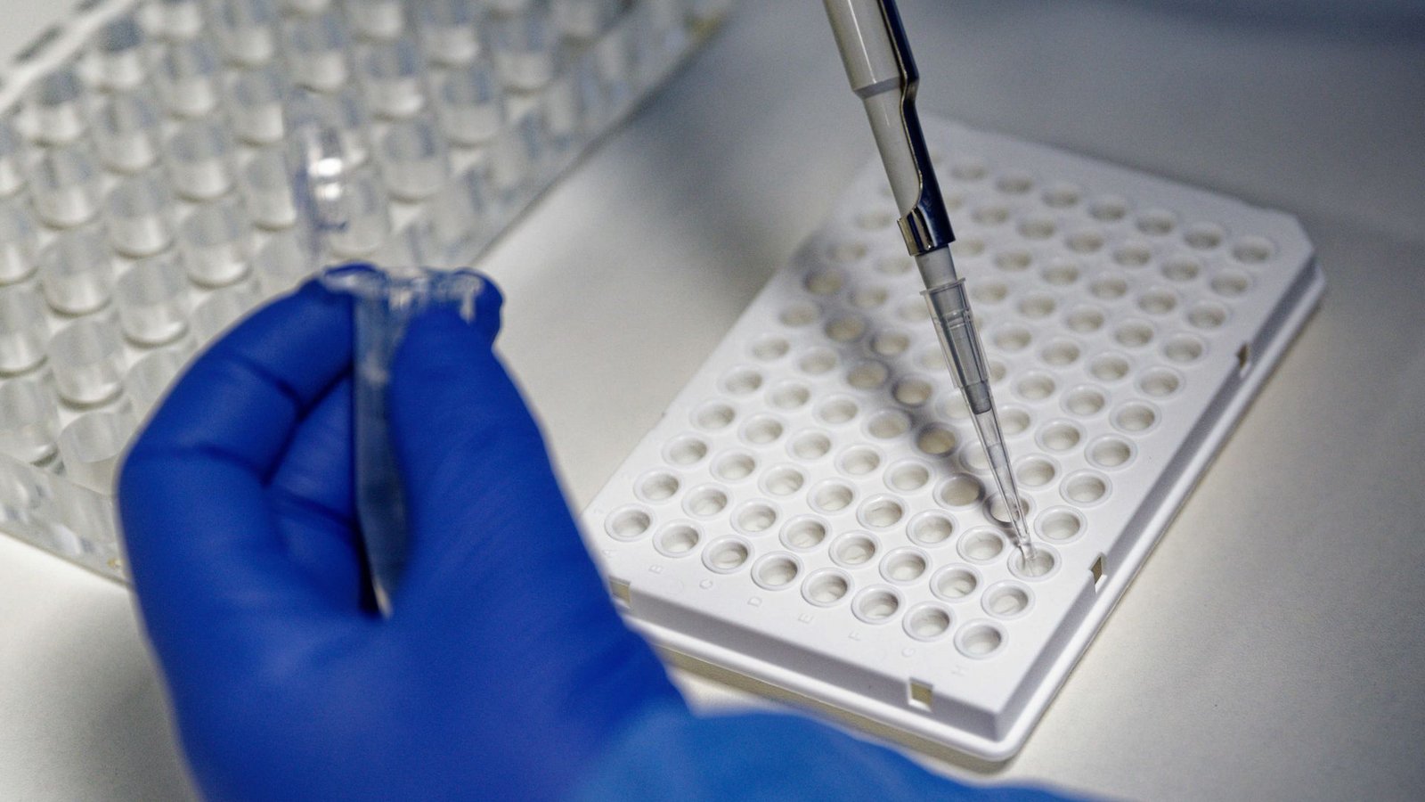 Eine Mitarbeiterin des Labors CBT füllt mit einer Pipette zur Vorbereitung von Corona PCR-Tests eine Testflüssigkeit in einer Trägerplatte.Foto: dpa/Henning Kaiser