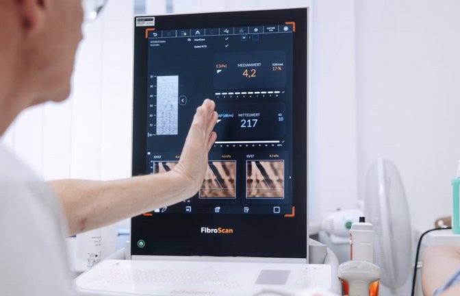 Prof. Dr. Jörg Albert, der Ärztliche Direktor der Klinik für Gastroenterologie im Klinikum Stuttgart, erklärt, dass aus Risikofaktoren abgeleitet wird, wie hoch das individuelle Risiko für Komplikationen ist.<span class='image-autor'>Klinikum Stuttgart/ Tobias Grosser</span>