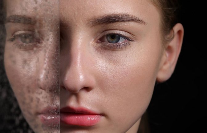 Der Glaube, viele verschiedene Personen in einem Körper zu sein, ist vor allem unter jungen Frauen sehr verbreitet. Viele sagen, sie seien Opfer von „ritueller, organisierter Gewalt“ geworden.<span class='image-autor'>Foto: imago images//Magdalena 
Lordache</span>