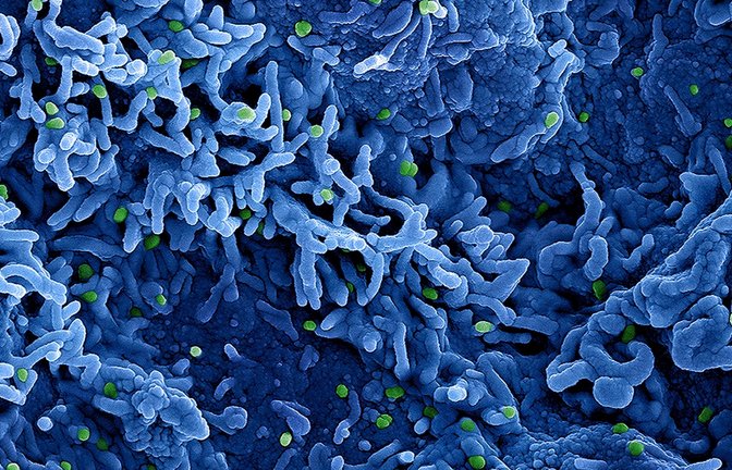 Eine kolorierte rasterelektronenmikroskopische Aufnahme des Affenpockenvirus (grün) auf der Oberfläche von infizierten VERO E6-Zellen (blau).<span class='image-autor'>Foto: Niaid/Niaid/Planet Pix via ZUMA Press Wire/dpa</span>