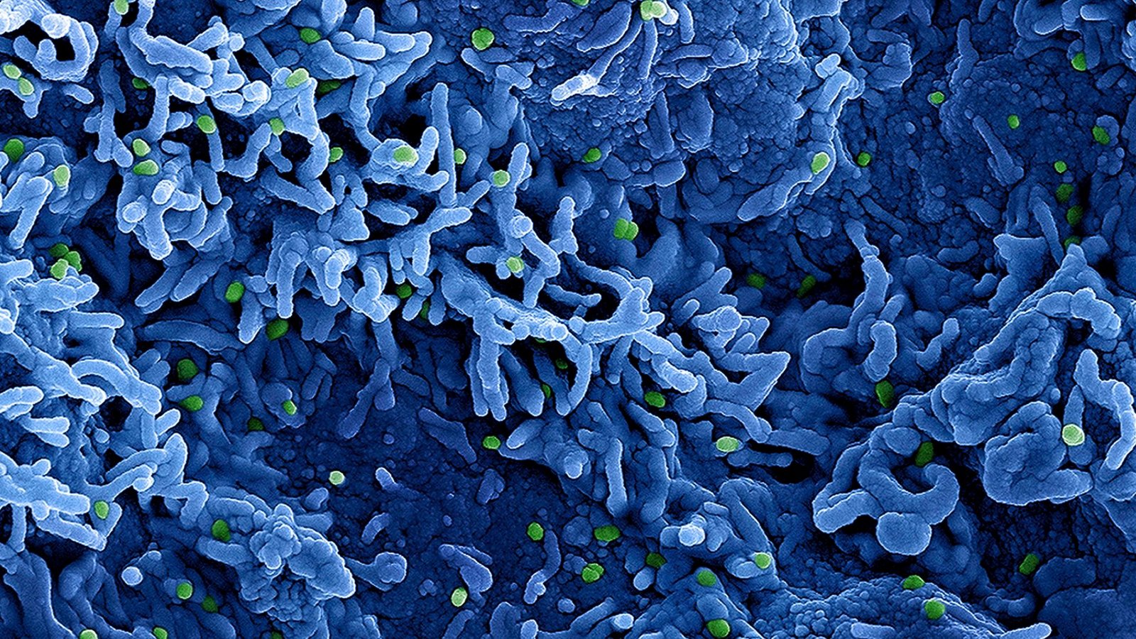 Eine kolorierte rasterelektronenmikroskopische Aufnahme des Affenpockenvirus (grün) auf der Oberfläche von infizierten VERO E6-Zellen (blau).Foto: Niaid/Niaid/Planet Pix via ZUMA Press Wire/dpa