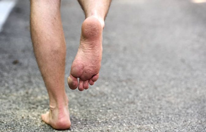 Eine Person läuft barfuß, also ohne Schuhe,  auf einem gepflasterten Weg läuft, wodurch der direkte Hautkontakt mit der Erde betont wird und Abdrücke im Fuß in der Haut sichtbar sind. Barfußlaufen fördert die natürliche Verbindung zur Natur und bietet ein Gefühl von Freiheit und Entspannung und ist gut für die Gesundheit und Durchblutung.<span class='image-autor'>Imago/Bihlmayerfotografie</span>
