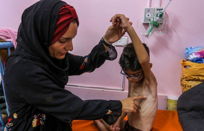 Ein palästinensisches Kind, das an schwerer Unterernährung leidet, wird von seiner Mutter im Nasser Medical Hospital gehalten (Archivfoto).<span class='image-autor'>Foto: Abed Rahim Khatib/dpa/Abed Rahim Khatib</span>