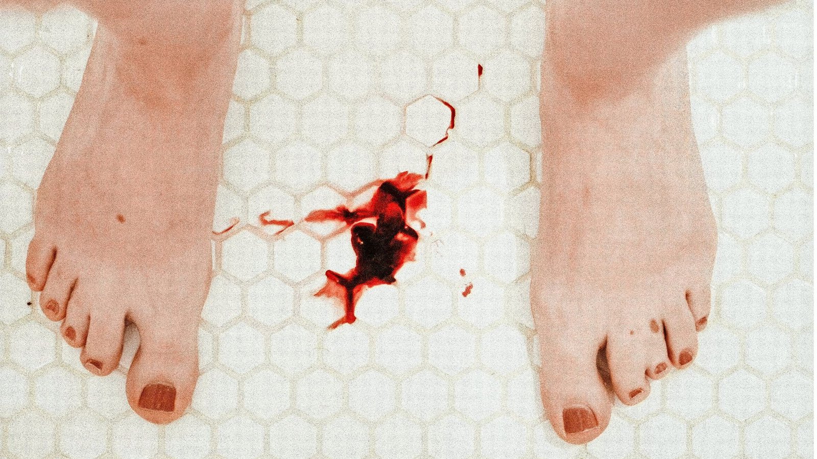 Die Periode der Frau war bis weit ins 20. Jahrhundert hinein ein Mittel, um Frauen auszugrenzen und als abnormal zu stigmatisieren.Foto: Unsplash/Monika Kozub Die Periode der Frau war bis weit ins 20. Jahrhundert hinein ein Mittel, um Frauen auszugrenzen und als abnormal zu stigmatisieren.Foto: Unsplash/Monika Kozub