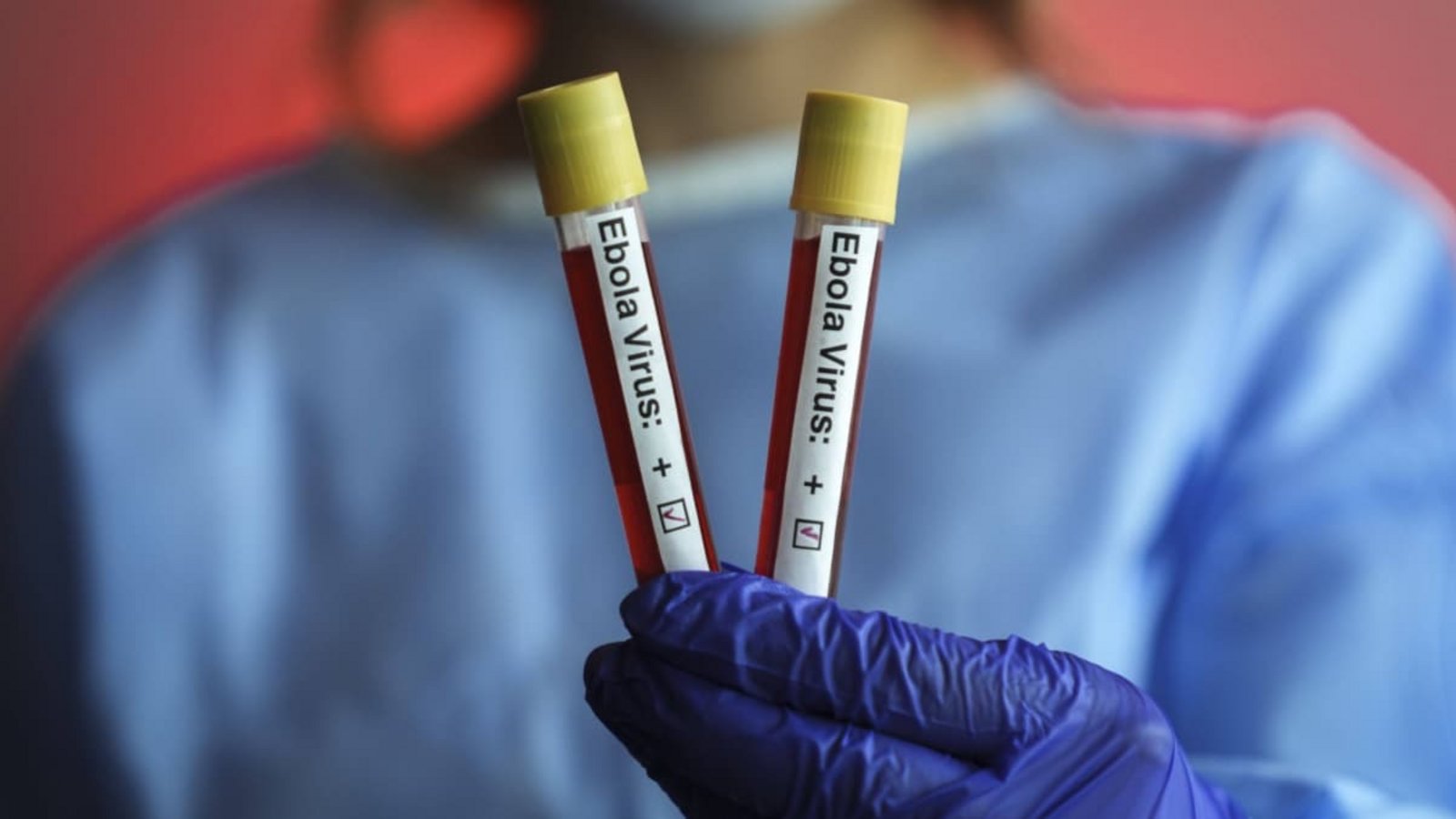 Ebolafieber ist eine Infektionskrankheit, die durch Viren der Gattung Orthoebolavirus hervorgerufen wird. Die Bezeichnung geht auf den Fluss Ebola in der Demokratischen Republik Kongo zurück, in dessen Nähe diese Viren 1976 den ersten allgemein bekannten großen Ausbruch verursacht hatten.Imago/Anadolu Agency