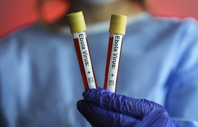 Ebolafieber ist eine Infektionskrankheit, die durch Viren der Gattung Orthoebolavirus hervorgerufen wird. Die Bezeichnung geht auf den Fluss Ebola in der Demokratischen Republik Kongo zurück, in dessen Nähe diese Viren 1976 den ersten allgemein bekannten großen Ausbruch verursacht hatten.<span class='image-autor'>Imago/Anadolu Agency</span>