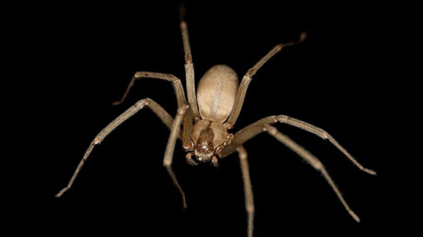 Braune Einsiedlerspinne (Loxosceles reclusa): Die sechs bis 20 Millimetern große Spinne kommt vor allem im Mittleren Westen bis in den Süden der USA vor. Ihr Biss ist meist schmerzlos und klein. Innerhalb der nächsten zwölf nehmen die Schmerzen zu, die betroffene Stelle wird größer. Weitere mögliche körperliche Symptome: Kopfschmerzen, Übelkeit, Erbrechen, Krämpfe und Muskelschmerzen.Foto: Wikipedia commons/Rosa Pineda/CC BY-SA 3.0 Braune Einsiedlerspinne (Loxosceles reclusa): Die sechs bis 20 Millimetern große Spinne kommt vor allem im Mittleren Westen bis in den Süden der USA vor. Ihr Biss ist meist schmerzlos und klein. Innerhalb der nächsten zwölf nehmen die Schmerzen zu, die betroffene Stelle wird größer. Weitere mögliche körperliche Symptome: Kopfschmerzen, Übelkeit, Erbrechen, Krämpfe und Muskelschmerzen.Foto: Wikipedia commons/Rosa Pineda/CC BY-SA 3.0