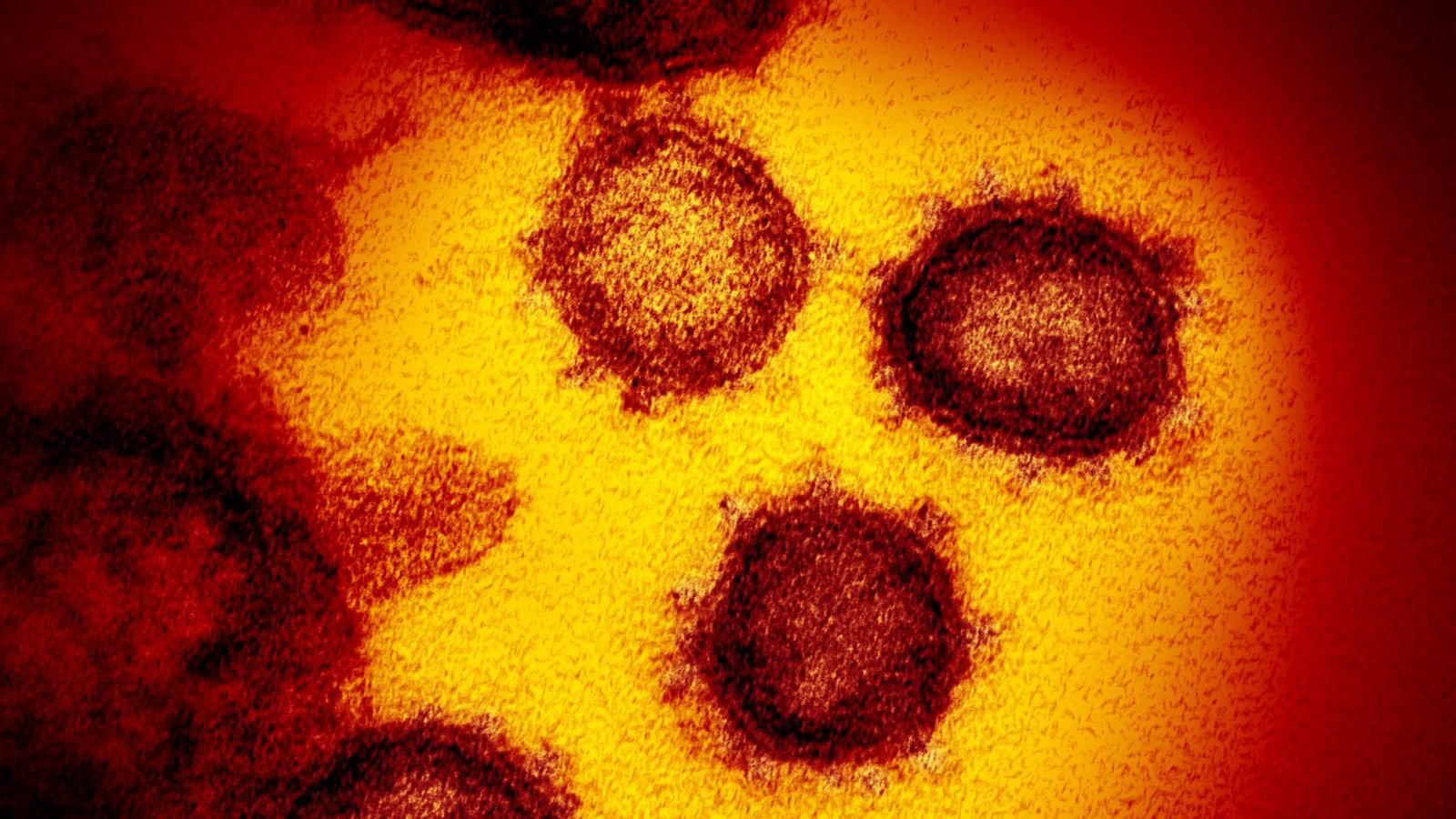 Das Coronavirus mutiert weiter, die neueste relevante Variante wird „Kraken“ genannt.Foto: Archiv //Rml Das Coronavirus mutiert weiter, die neueste relevante Variante wird „Kraken“ genannt.Foto: Archiv //Rml