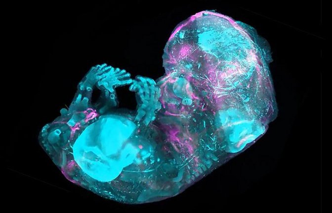 Forscher haben bis auf die Zellebene entschlüsselt, wie das Skelett eines menschlichen Embryos entsteht und wächst.<span class='image-autor'>Foto: © A.Chédotal & R. Blain/Institut de la Vision, Paris & MeLiS/UCBL/HCL, Lyon</span>