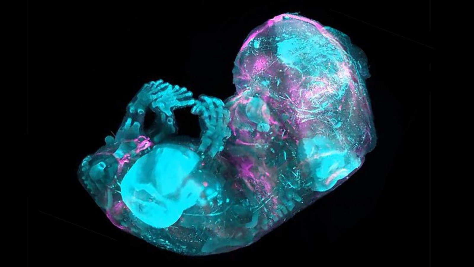 Forscher haben bis auf die Zellebene entschlüsselt, wie das Skelett eines menschlichen Embryos entsteht und wächst.Foto: © A.Chédotal & R. Blain/Institut de la Vision, Paris & MeLiS/UCBL/HCL, Lyon Forscher haben bis auf die Zellebene entschlüsselt, wie das Skelett eines menschlichen Embryos entsteht und wächst.Foto: © A.Chédotal & R. Blain/Institut de la Vision, Paris & MeLiS/UCBL/HCL, Lyon