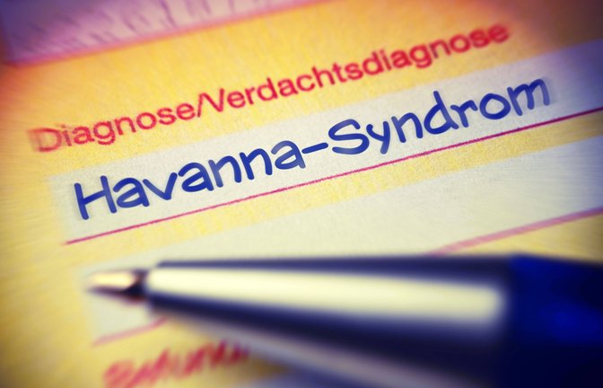Havanna-Syndrom: Betroffene gaben an, dass die Symptome begannen, nachdem sie etwa ein seltsames Geräusch hörten oder starken Druck in ihrem Kopf spürten.<span class='image-autor'>Foto: Imago/Christian Ohde</span>