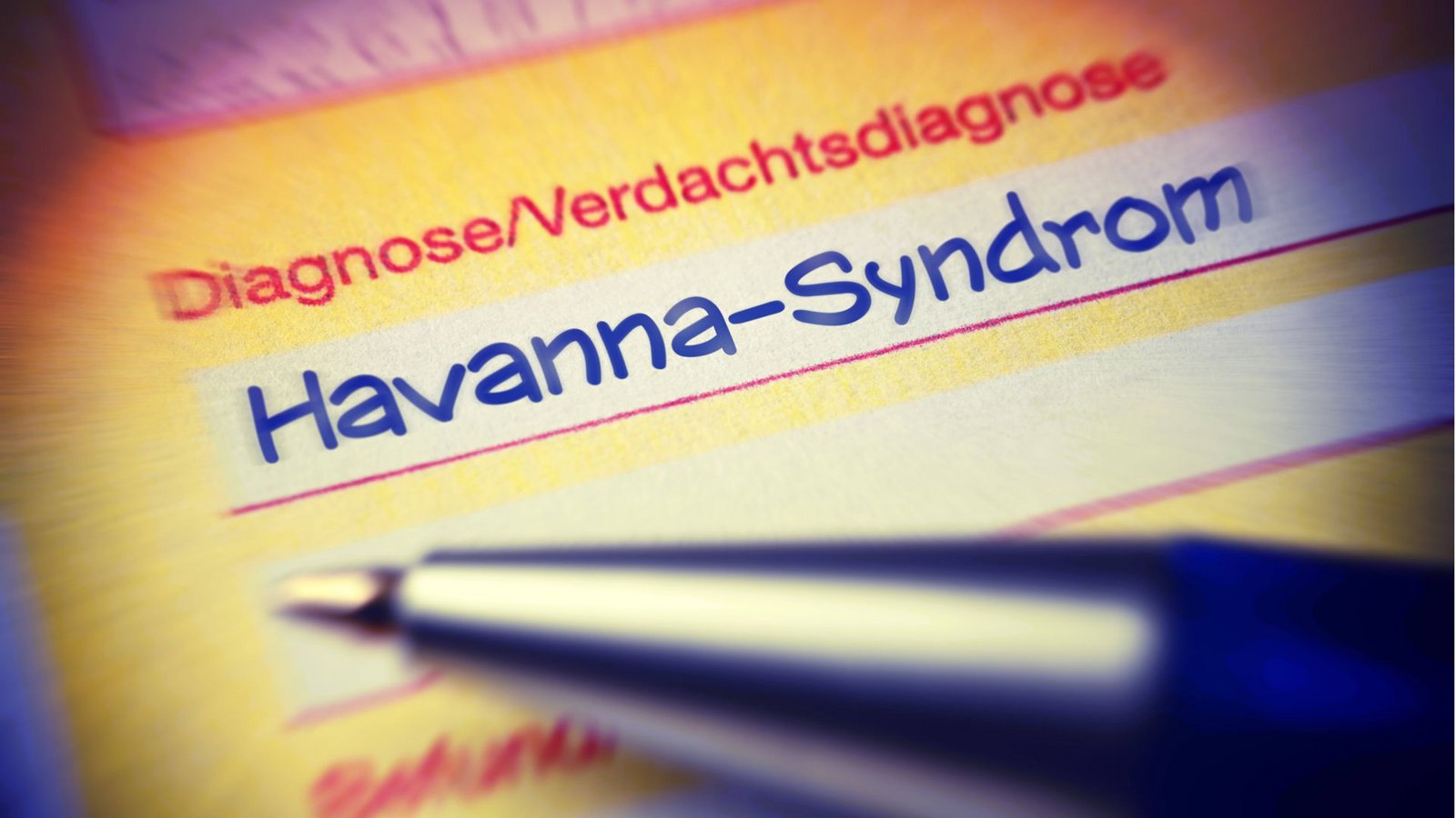 Havanna-Syndrom: Betroffene gaben an, dass die Symptome begannen, nachdem sie etwa ein seltsames Geräusch hörten oder starken Druck in ihrem Kopf spürten.Foto: Imago/Christian Ohde Havanna-Syndrom: Betroffene gaben an, dass die Symptome begannen, nachdem sie etwa ein seltsames Geräusch hörten oder starken Druck in ihrem Kopf spürten.Foto: Imago/Christian Ohde