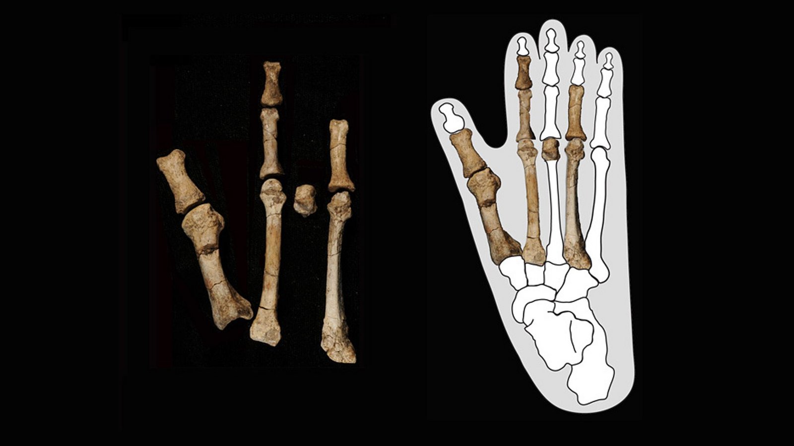 Diese 3,4 Millionen Jahre alten Knochen aus Äthiopien stammen vom Fuß eines Vormenschen. Aber von welchem? Das haben neue Fossilfunde nun geklärt.Foto: © Yohannes Haile-Selassie Diese 3,4 Millionen Jahre alten Knochen aus Äthiopien stammen vom Fuß eines Vormenschen. Aber von welchem? Das haben neue Fossilfunde nun geklärt.Foto: © Yohannes Haile-Selassie